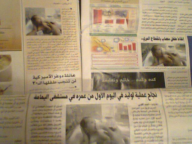 Newspaper Medical Milestones Article